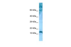 Aviva Systems Biology Corp RPL36 Antibody - N-terminal region (ARP64986_P050)