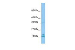 Aviva Systems Biology Corp LALBA Antibody - N-terminal region (ARP65087_P050)