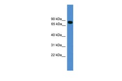 Aviva Systems Biology Corp IWS1 Antibody - N-terminal region (ARP65333_P050)