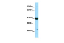 Aviva Systems Biology Corp NANS Antibody - C-terminal region (ARP65353_P050)