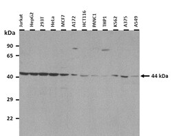 Aviva Systems Biology Corp GPR34 Antibody - C-terminal region (ARP65572_P050)
