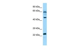 Aviva Systems Biology Corp DUSP14 Antibody - C-terminal region (ARP65655_P050)