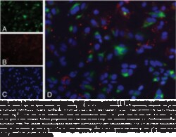 Cayman Chemical&nbsp;LDL Uptake CellBased Assay Ki