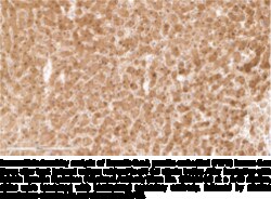 Cayman Chemical&nbsp;Soluble Epoxide Hydrolase Pol