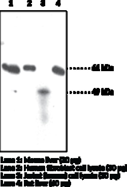 Cayman Chemical&nbsp;SOAT2 ACAT2 Polyclonal Antibo