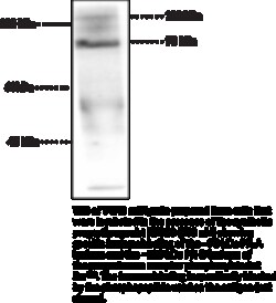 Cayman Chemical&nbsp;Progesterone Receptor  Phosph