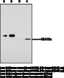 Cayman Chemical&nbsp;Monoacylglycerol Lipase  FL P