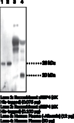Cayman Chemical&nbsp;Serum Retinol Binding Protein