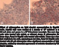 Cayman Chemical&nbsp;Steatosis Colorimetric Assay