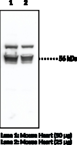 Cayman Chemical&nbsp;Adipose Triglyceride Lipase P