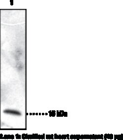 Cayman Chemical&nbsp;Cellular Retinol Binding Prot