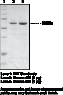 Cayman Chemical&nbsp;Soluble Epoxide Hydrolase  mo