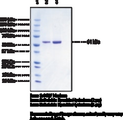 Cayman Chemical&nbsp;Soluble Epoxide Hydrolase  hu