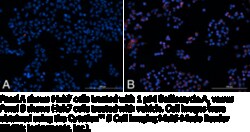 Cayman Chemical&nbsp;Lysosomal Staining Kit (Red Fluorescence), 96 Well