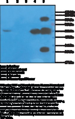 Cayman Chemical&nbsp;TNFa ChImRIc MouseHumn Mo