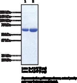 Cayman Chemical&nbsp;Alpha-1 ntItrypsIn 100ug
