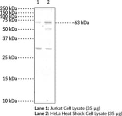 Cayman Chemical&nbsp;YTHDF2 PolycLNal ANTIBDY 500uL