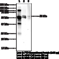 Cayman Chemical&nbsp;FTOhumn Monclonal ntIbo 100ug