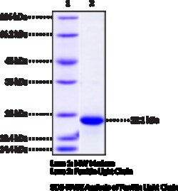 Cayman Chemical&nbsp;FerrItIn LIght ChaInhumn100ug