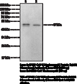 Cayman Chemical SARSCoV2 NucleocapsId Prote