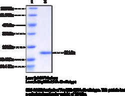 Cayman Chemical FcRIIIb/CD16b HNA-1b allotyp
