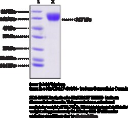 Cayman Chemical cKItCD117 GnK− Isoform EX