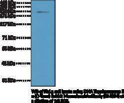 Cayman Chemical DNA TopoIsomRase IIaCTRm 100uL