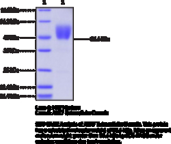 Cayman Chemical&nbsp;ALK7 EXrAClular DomaInhu 200ug