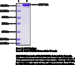 Cayman Chemical&nbsp;TIe2CD202b EXrAClular Dom
