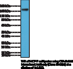 Cayman Chemical CEA RabbIt MoncLNal ntIbod, Quantity: Each of 1