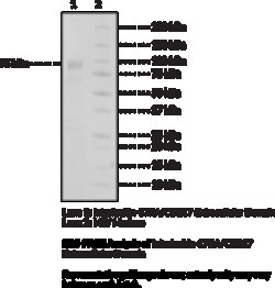 Cayman Chemical&nbsp;InTRleukIn17RACD217 EXrac