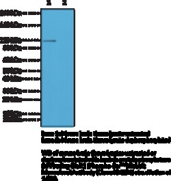 Cayman Chemical&nbsp;GluR1PhosphoSR845 RabbIt 100uL