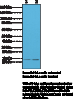 Cayman Chemical&nbsp;MAP1LC3BLC3BNTerm RabbIt 100uL