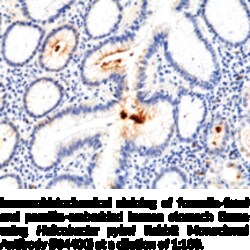 Cayman Chemical HelIcobacTR pylorI RabbIt Mo