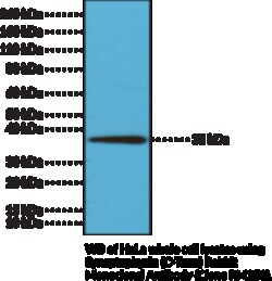 Cayman Chemical&nbsp;SynaptophysInCTRm RabbIt 100uL