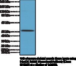 Cayman Chemical&nbsp;MyoD1 RabbIt MoncLNal ntIb