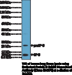 Cayman Chemical&nbsp;Surfactnt ProteIn B RabbIt M