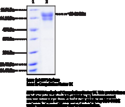 Cayman Chemical CoagulatIon Factr IXhumn1mg