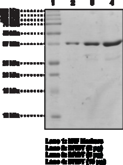 Cayman Chemical&nbsp;BRDT bromodomaIn 1humnre 100ug
