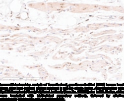 Cayman Chemical&nbsp;CysLT2 ReceptrN-Term Poly 1ea