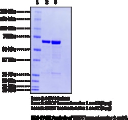 Cayman Chemical&nbsp;BRDT bromodomaIns 1 nd 2hu