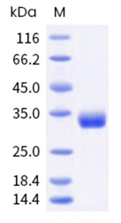 Sino Biological Recombinant Mouse Angiopoietin-2/ANGPT2 Protein (His Tag),