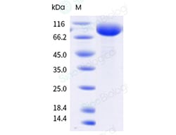 Sino Biological&nbsp;Recombinant Human IL-5R alpha Protein (Membrane-bound, hFc Tag), HPLC-verified