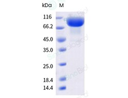 Sino Biological&nbsp;Recombinant Human CD10/Neprilysin Protein, Biotinylated