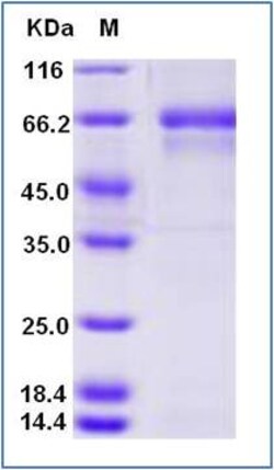 Sino Biological Human ALB 100ug