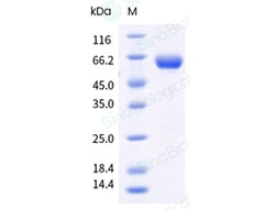 Sino Biological&nbsp;Recombinant Human DDR1 Protein (His & AVI Tag), Avi-tag Biotinylated, HPLC-verified