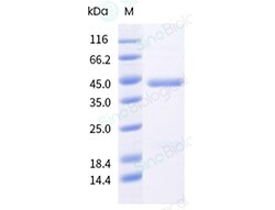 Sino Biological&nbsp;Human respiratory syncytial virus RSV (A2) Post-fusion glycoprotein F/ RSV post-F Protein (His Tag)(MALS-verified)
