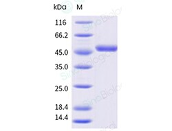 Sino Biological&nbsp;Recombinant Human CD40 Ligand/TNFSF5 Protein (ECD, Low Endotoxin, hFc Tag), HPLC-verified