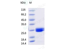 Sino Biological&nbsp;Recombinant Cynomolgus FGF-21 Protein (His Tag), HPLC-verified