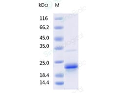 Sino Biological&nbsp;Recombinant Cynomolgus IL-1 beta Protein (His & AVI Tag), Avi-tag Biotinylated